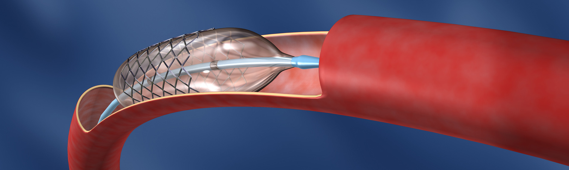Humidification & humidity control in medical device manufacturing Humidification & humidity control in medical device manufacturing